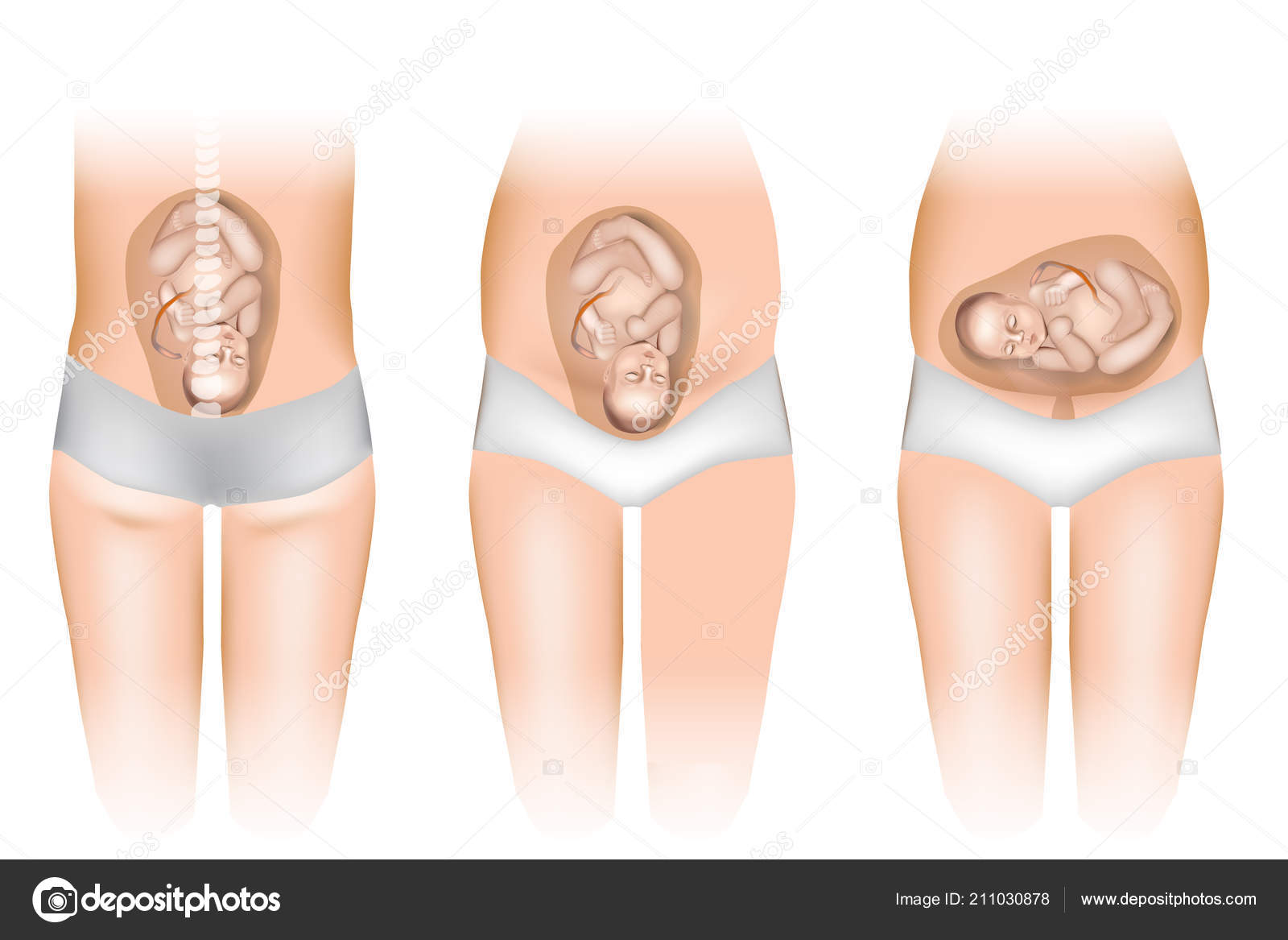 卵巣の位置ってどこか知ってる？機能を良くするセルフケアと定期検診の重要性について紹介東京・ミネルバクリニック