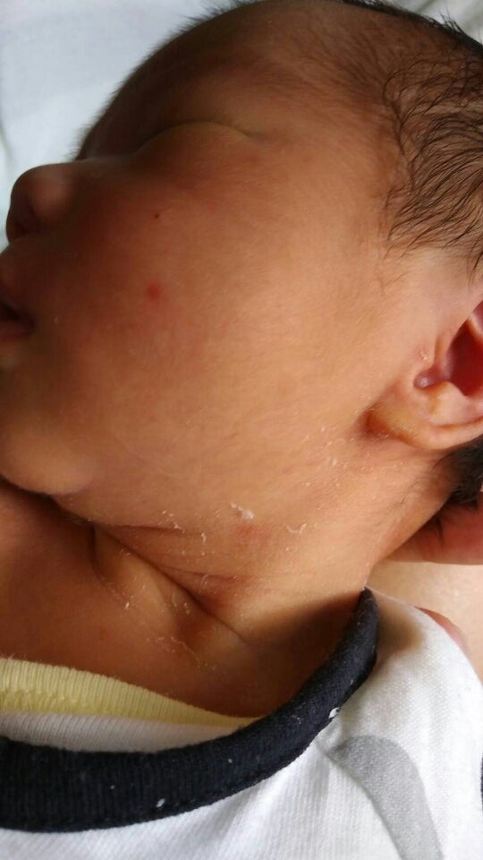 小児科医監修 新生児落屑とは？いつからいつまで続く？ケアの方法ままのて