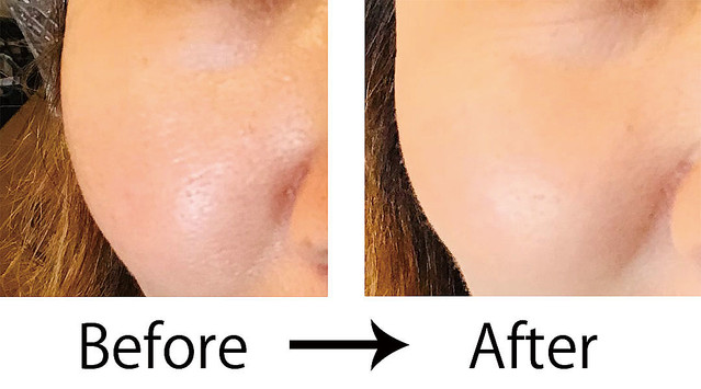 皮膚疾患の俗説に惑わされるな：Aナーシング