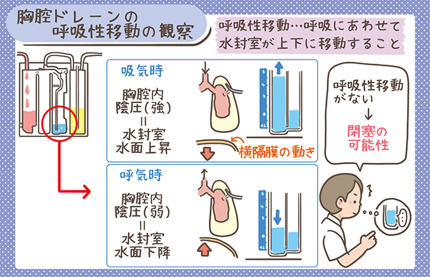 胸腔ドレナージシミュレーター - 60230 - Limbs & Things - 医療訓練用手術用気胸