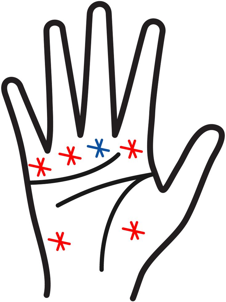 薬指の下 太陽丘 に縦線・横線・トライデント・環紋がある意味？uranai cafe Quartz 占いカフェクオーツ