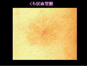 手のひらが黄色い＝ストレスのサイン？肝臓の不調？病気の恐れは？病院に行く目安もMedicalook メディカルック