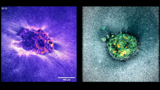 胚発育のタイムラプス観察 ICSI後〜胚盤胞