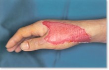 やけど名古屋市昭和区の皮膚科・美容皮膚科クリニックいりなか駅前皮フ科ビューティークリニック