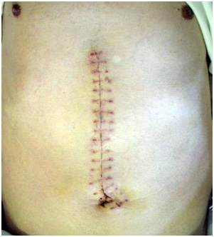 腹腔鏡下手術について患者さんへ東京女子医科大学 産婦人科