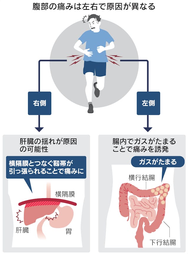 1.腹痛の原因となる病気は？急にお腹が痛くなったら 一般の方へ日本臨床外科学会