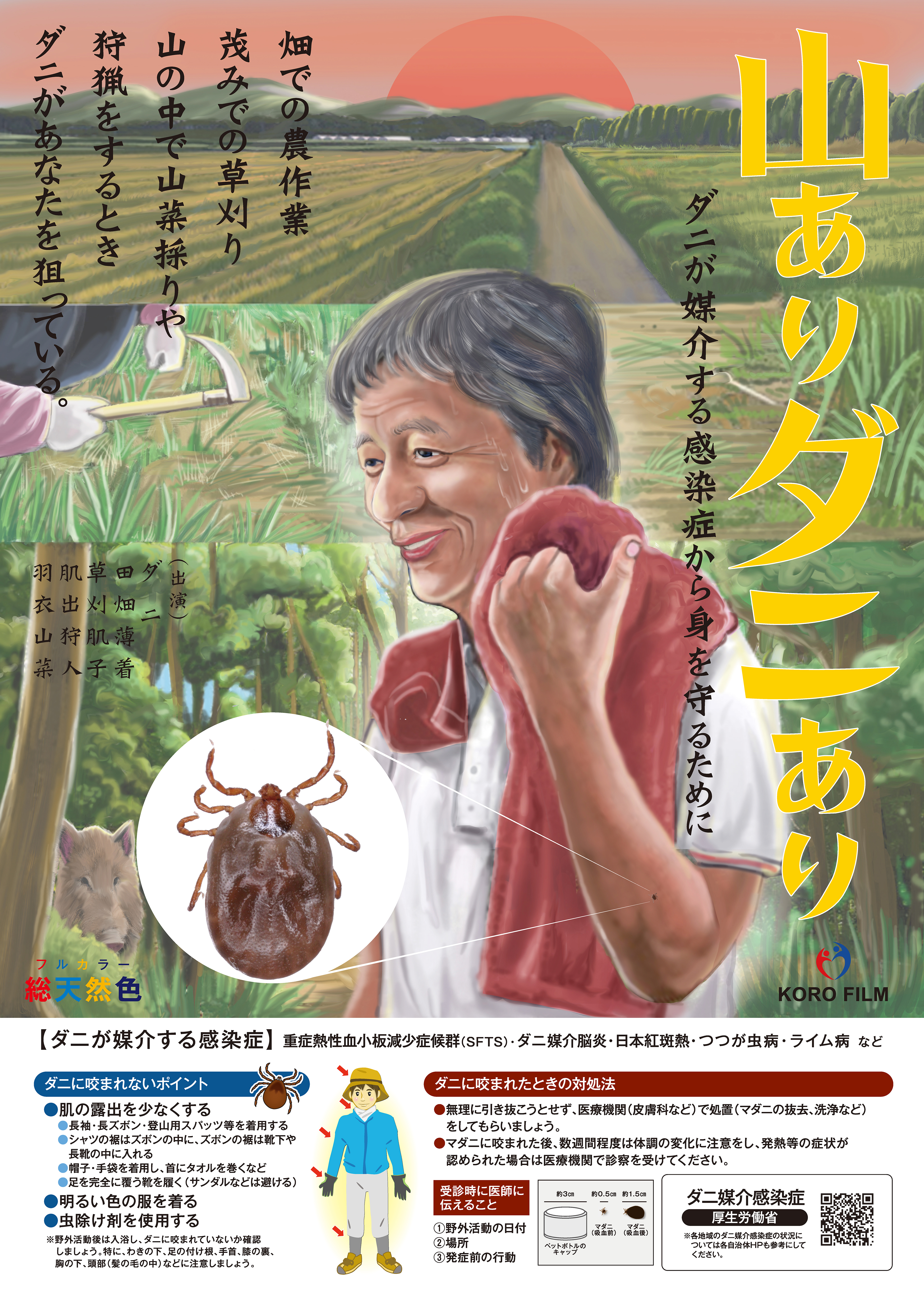ダニ咬傷！ 除去と治療はこうしよう：日経メディカル
