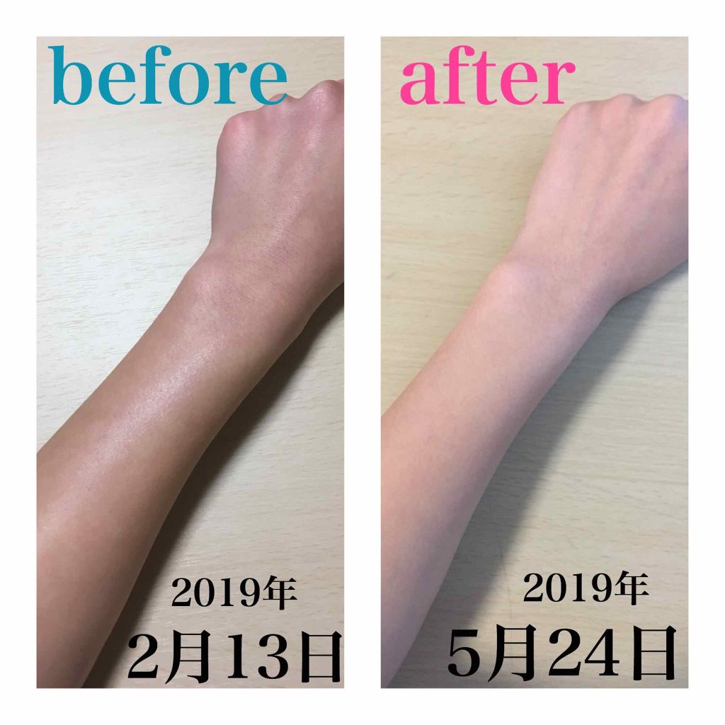 スキンケア方法 DHC ビタミンＣハードカプセルDHCの使い方・効果 -当たり前をコツコツ頑張ったら白くなりました！ by紗々🌸フォロバ100 投稿ある方敏感肌 30代前半LIPS