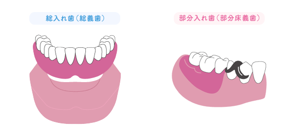 歯医者の治療回数が多くなるのはなぜ？町田駅徒歩3分の歯医者町田歯科・矯正歯科