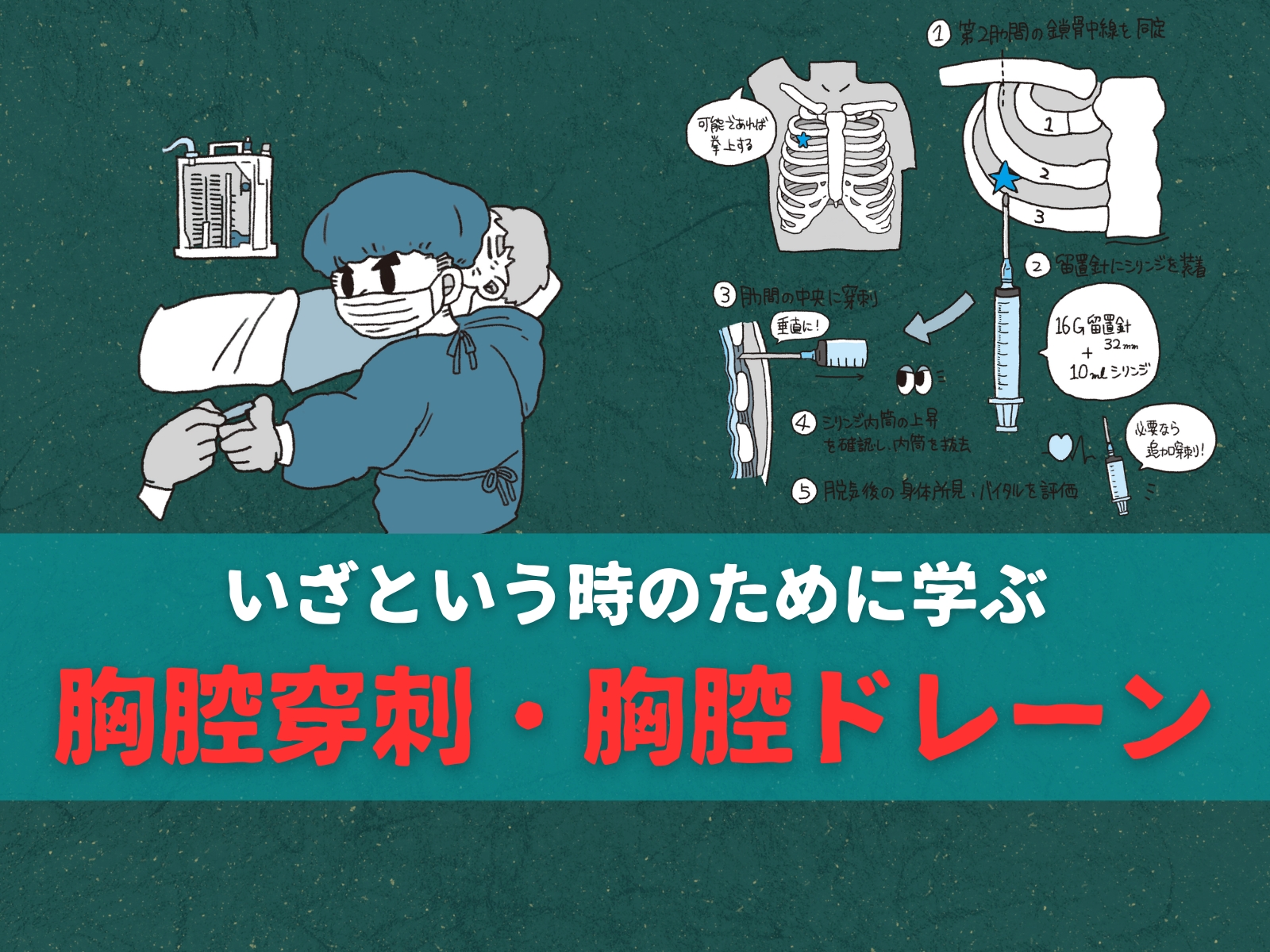 胸腔ドレーン管理でのフルクテーション 呼吸性移動 の観察方法とは？エキスパートナースweb
