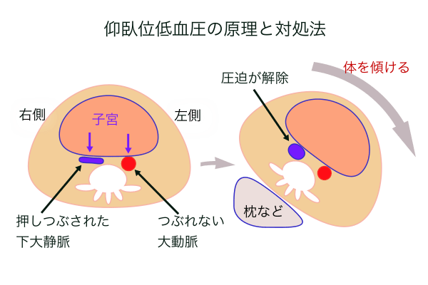 シムス位イラスト無料イラスト・フリー素材なら「イラストAC」