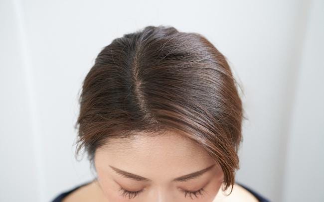 女性のつむじはげはどこから？基準や原因、目立たない髪型まで 公式 ウィルAGAクリニックレディース