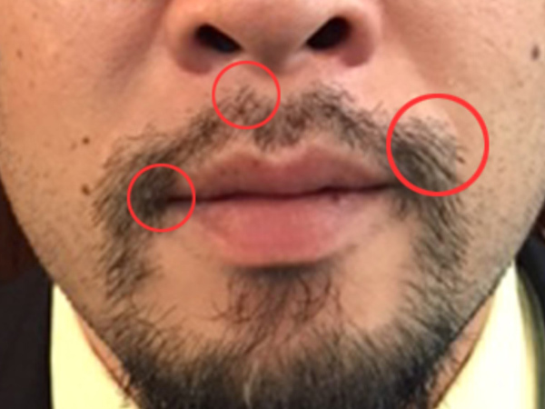 髭の長さはバリカン何ミリがいい？3ミリ？6ミリ？理容師が解説！ - サロンセブン