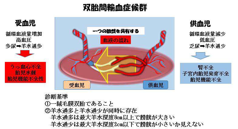 一卵性双胎の謎を解き明かす: 妊娠から出産まで東京・ミネルバクリニック