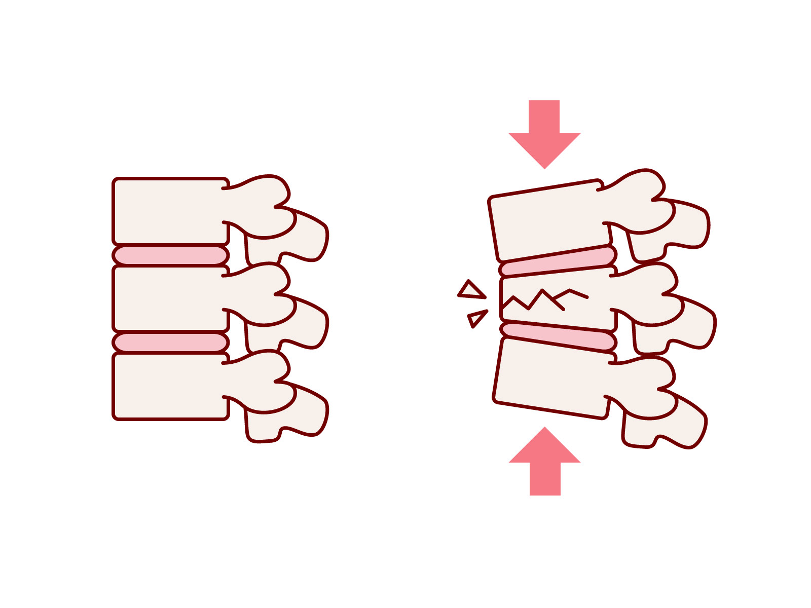 ピラティスで身長が伸びる?：2025年6月12日スタジオティーティー 綱島店 STUDIO TT のブログホットペッパービューティ