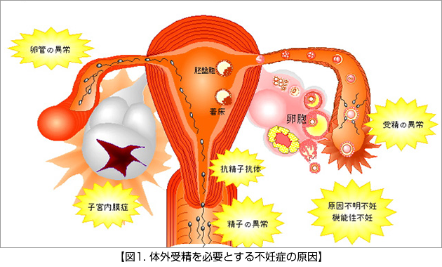 30代女性の体外受精の成功率不妊に悩んだら早めの受診を木場公園クリニック-JISART認定 体外受精・顕微授精