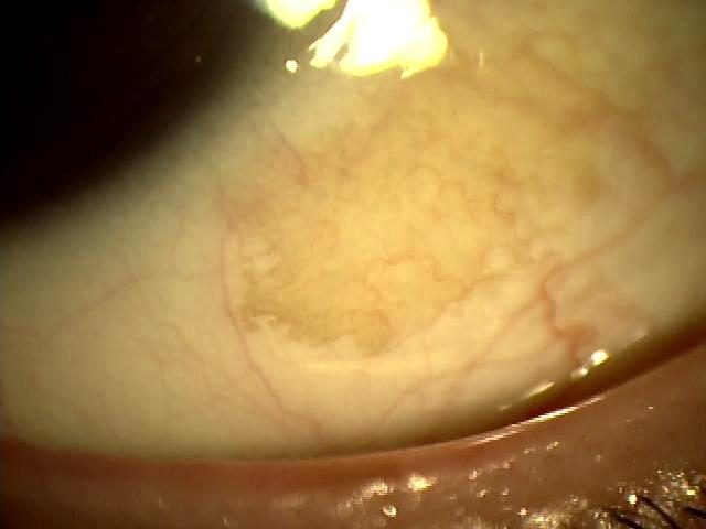 瞳の周囲にオレンジ色のリングで黄色の外国人の目の写真素材・画像素材 Image 39341113