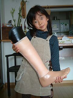 兄の両脚切断で義肢装具士に パラ自転車・藤田征樹の弟、悠介さん毎日新聞