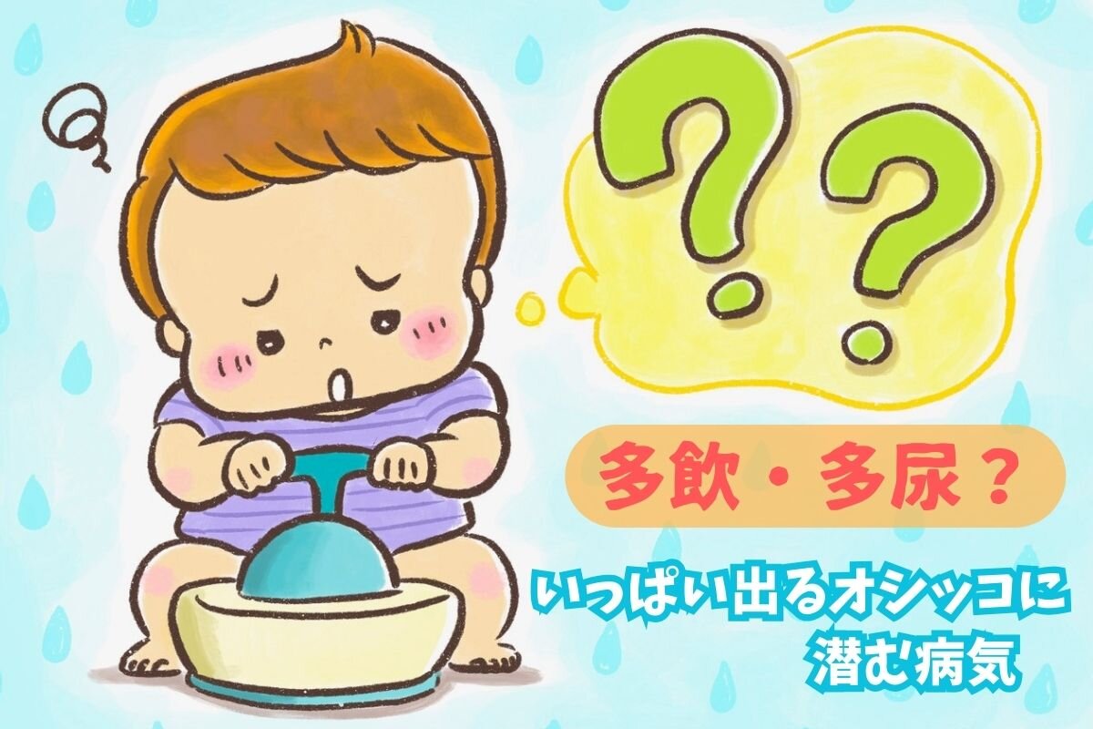 赤ちゃんのうんちの色からわかること - 小児科オンラインジャーナル