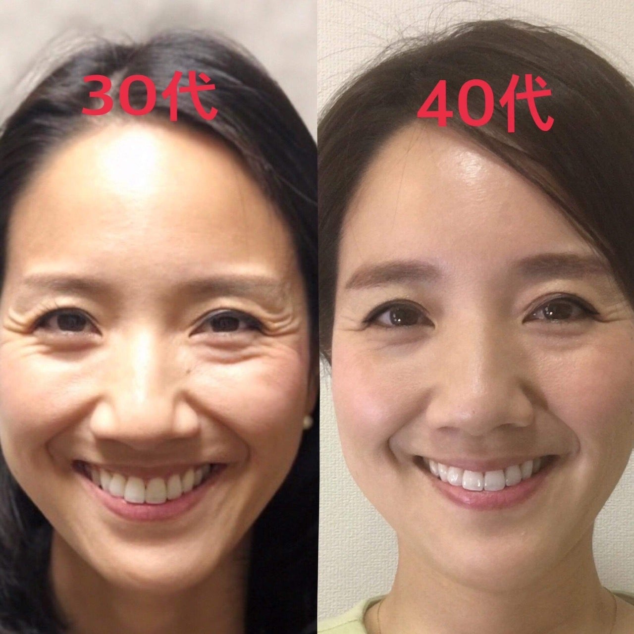 目尻にできる笑いジワを即解決！ハリのある目元を手にするワザ Q& 038;Aビューティニュース 美容メディアVOCE ヴォーチェ