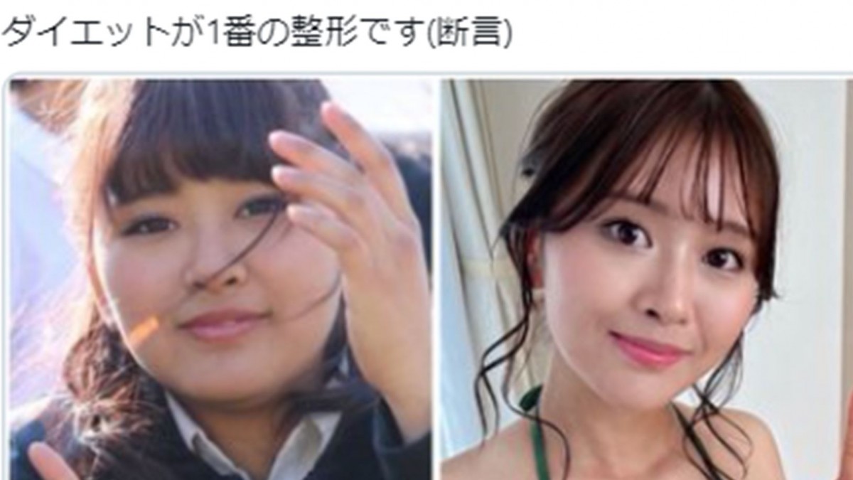 美容に目覚めたオカリナ、最新美容整形「ハイフ」挑戦で驚きの結果に!?ENCOUNT