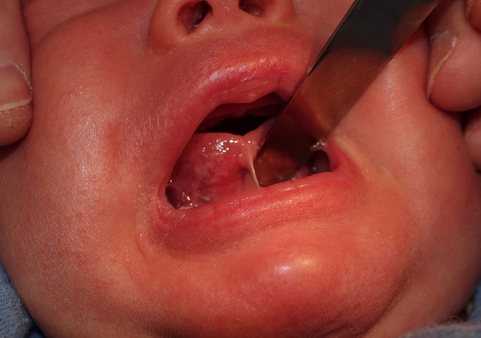 スプリットスクワット」のやり方や効果は？下半身を鍛えるコツも紹介 - Wellulu