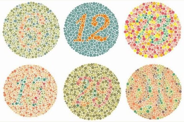 色覚異常・色覚検査について的場眼科クリニック