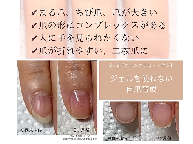 爪の横幅が広い、自分の爪の形が嫌だ ネイルカンパニー 爪補強 グラスネイル