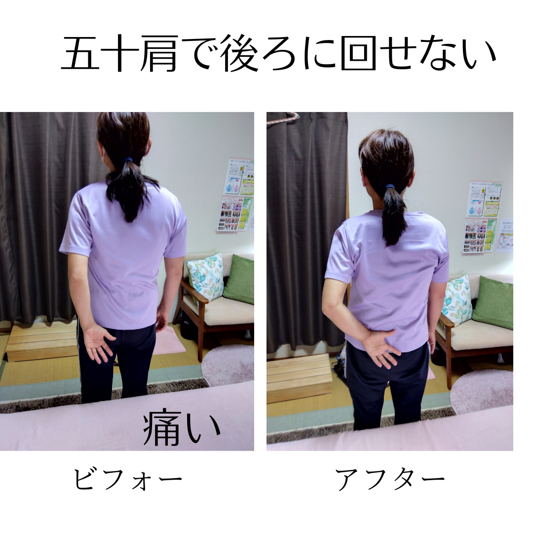 偏頭痛の方にオススメ！頭や頭皮が痛くならないヘアアレンジC CHANNEL