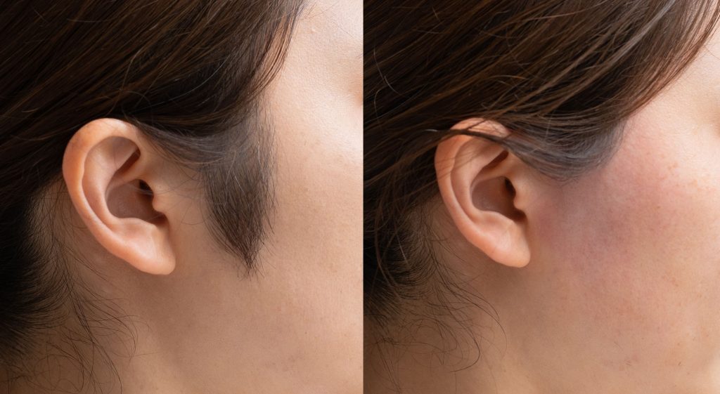 後頭部首の付け根押すと痛い