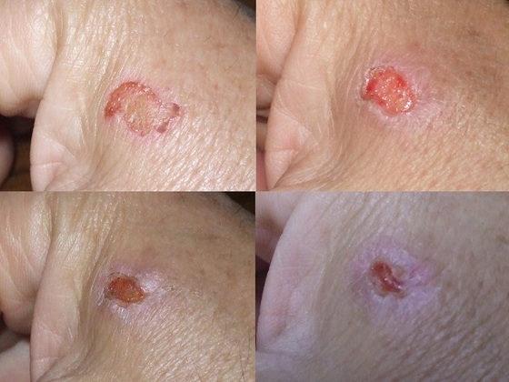 犬のノミ刺症、ノミアレルギー性皮膚炎って？原因・症状・治療・予防法まとめ 獣医皮膚科専門医が解説どうぶつの皮膚科・耳科・アレルギー科