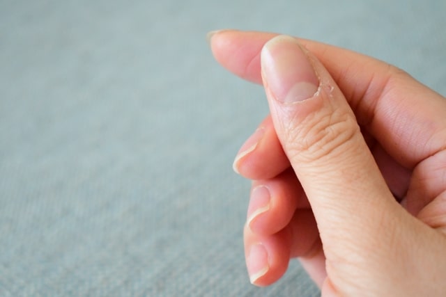 糖尿病になると水虫に注意しなければならない理由ドクターズチョイス健康情報集