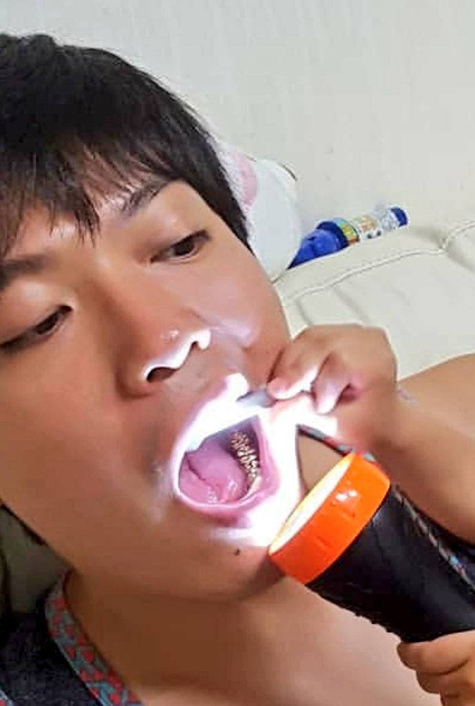 😌素肌美への条件は😌 ターンオーバー 新陳代謝 が正常に行われている事！ ピーリング 剥離 後のフィルター画像左写真 昨年12月より肌断食開始のAさん 右写真 肌断食2年目のBさん Aさんの肌はターンオーバーが上手く出来ず古い角質が 蓄積されている状態。毎日、保湿