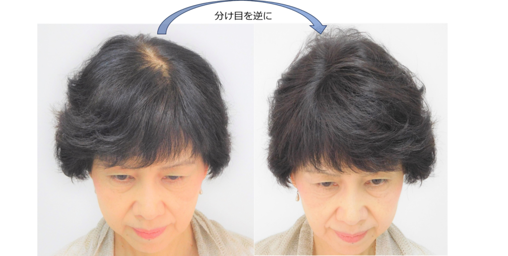 こめかみが薄い状態は髪型で解決できる！女性向けスタイルをレングス別に紹介 - SENJYUプロフェッショナルチーム