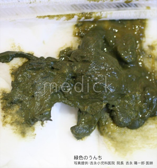 医療レポート 17便の色で分かる危険サイン 実は成人でも多い緑色の便？青葉区タウンニュース