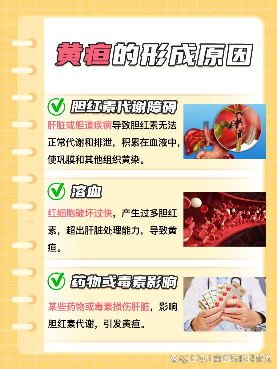 了解了黄疸是啥，到时你就不会慌- 每日头条