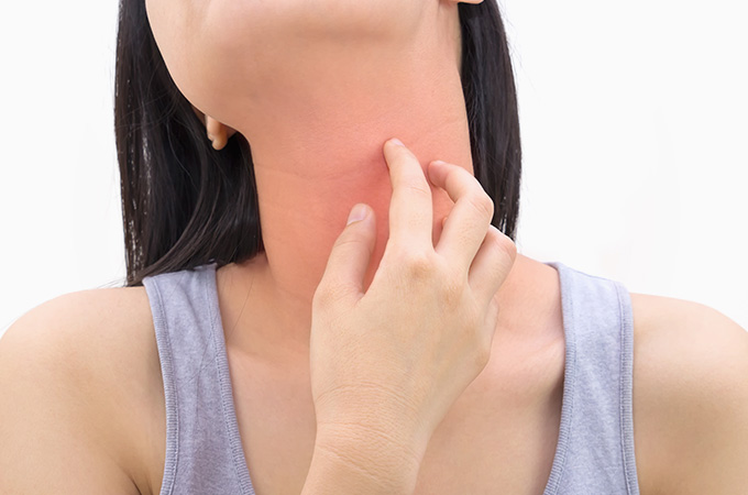 そのかゆみ、ストレスが原因かも