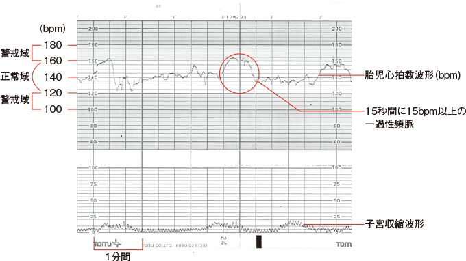 脈が速い、脈が遅い医知場 いちば