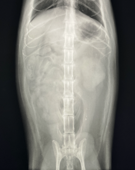 尿路結石症 尿管結石、腎臓結石、膀胱結石 の治療まるばね泌尿器科クリニック北区東十条