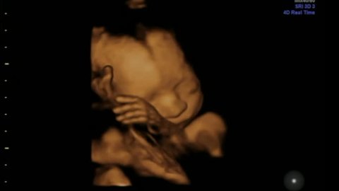 2,090 へその緒 Stock Photos, High-Res Pictures, and Images - Getty Images出産,胎児, 泣く