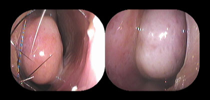 見てわかる鼻の病気 耳鼻咽喉科内藤クリニック