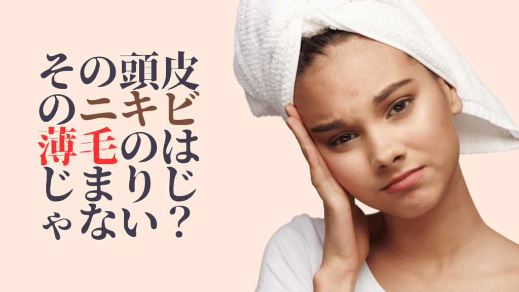 頭皮にできるニキビの原因とは？ニキビを防ぐ対策方法もご紹介！駅前AGAクリニック 新宿、北千住、大阪、京都、岡山、鹿児島など