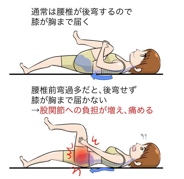 楽天市場 股関節の構造と損傷 ポスター J9802P 股関節損傷 股関節骨折 人工股関節 人体解剖図 医学ポスター 医学チャート : 人体百科楽天市場店