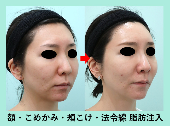 可愛い表情でかわいい柔らかい顔を設定します。のイラスト素材・ベクター Image 80034073