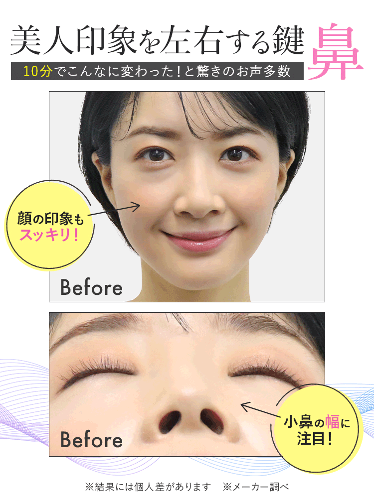 LUXCEAR公式 ノーズクリップ 鼻を高く Fornez 鼻矯正 鼻専用美顔器 鼻クリップ 鼻プチ 美鼻 ルクセア フォーネス :LUXCEAR 公式ショップ - 通販 - Yahoo!ショッピング