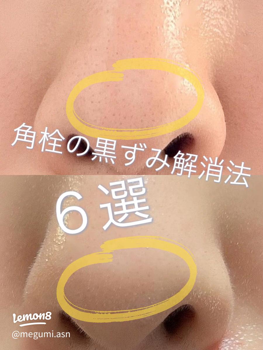 毛穴の詰まりや角栓はサウナで解消できる？ - あしたの美肌