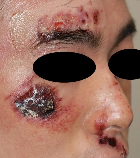 顔面の外傷家庭の医学時事メディカル時事通信の医療ニュースサイト