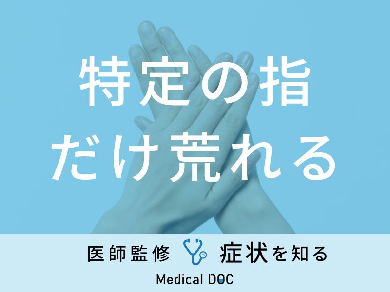湿疹 皮膚炎 原因・症状・対策・予防法大正健康ナビ大正製薬
