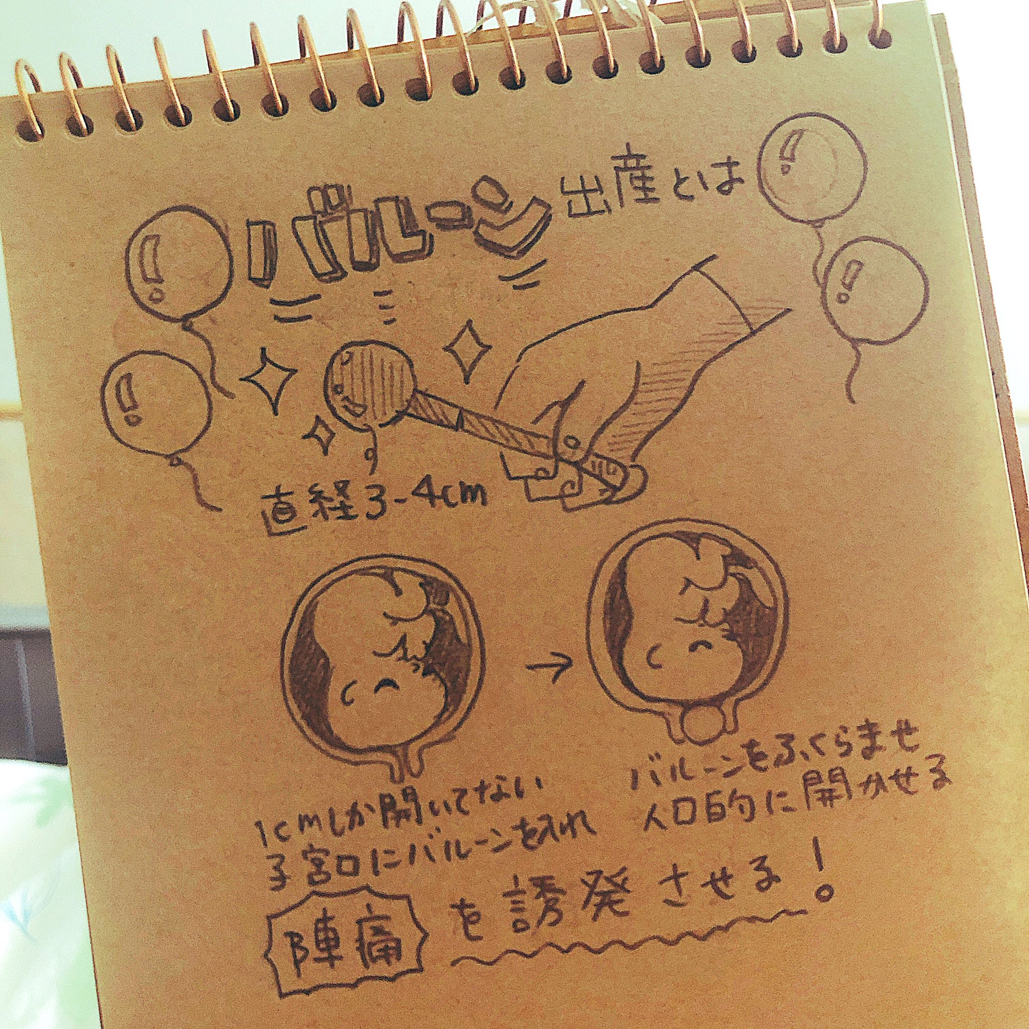 出産レポ 赤ちゃん産みました☆計画無痛分娩第三子促進剤バルーン経産婦 - YouTube