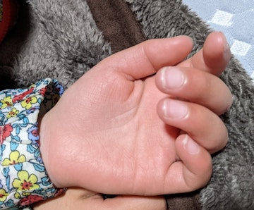 ヘルパンギーナってどんな病気？ まんがでチェック おしえて！トリートマンこどもオレンジページnetおしえて！トリートマンオレンジページnet